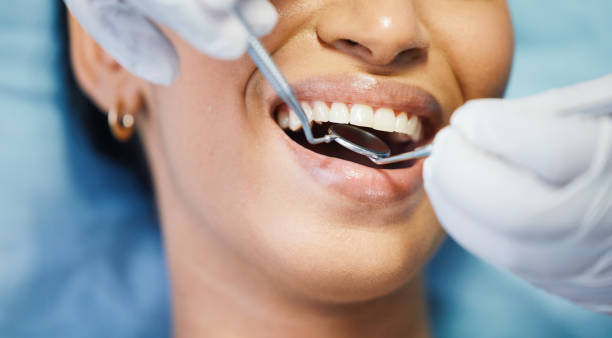 Best Emergency Tooth Extraction in East Milton, FL